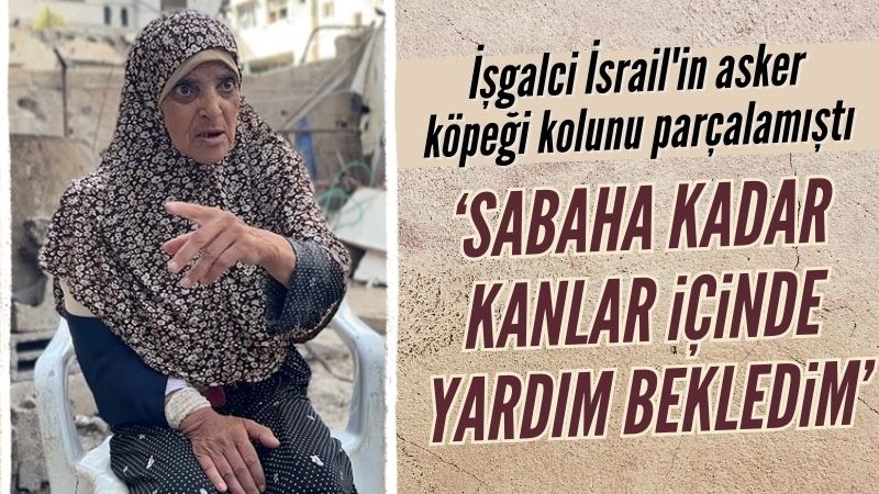 İsrail'in asker köpeği tarafından kolu parçalanan kadın o anları anlattı