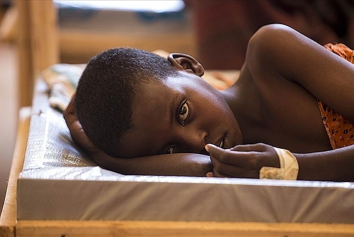 Kamerun'da kolera salgınında vaka sayısı 4 bin 500'ü aştı